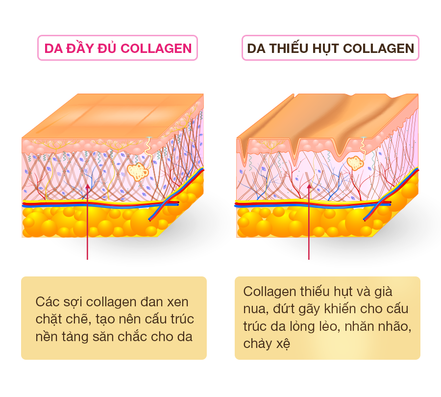 Tổng quan về Collagen. Collagen là gì? Tại sao cần phải uống… | by Colly Collagen Vietnam | Medium