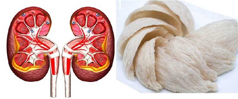 BỆNH SUY THẬN CÓ ĂN ĐƯỢC TỔ YẾN KHÔNG? - Yến Sào Hoàng Phi